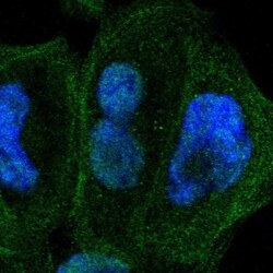 ZNF74 Antibody, Novus Biologicals 25 &mu;L; Unlabeled:Antibodies, Polyclonal